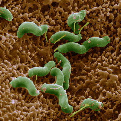 Helicobacter pylori16k